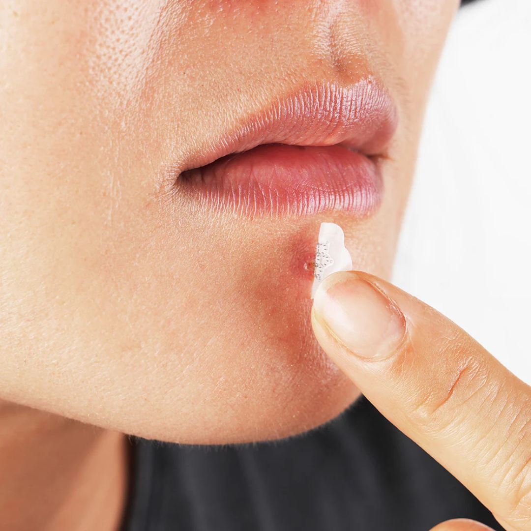 Гідроколоїдні пластирі від прищів Trouble Spot Patch (S) 12mm, LALARECIPE