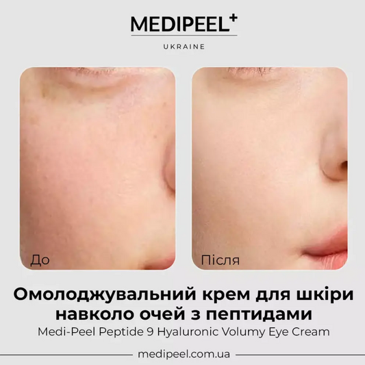 Омолоджувальний крем для шкіри навколо очей з пептидами Peptide 9 Hyaluronic Volumy Eye Cream, MEDIPEEL