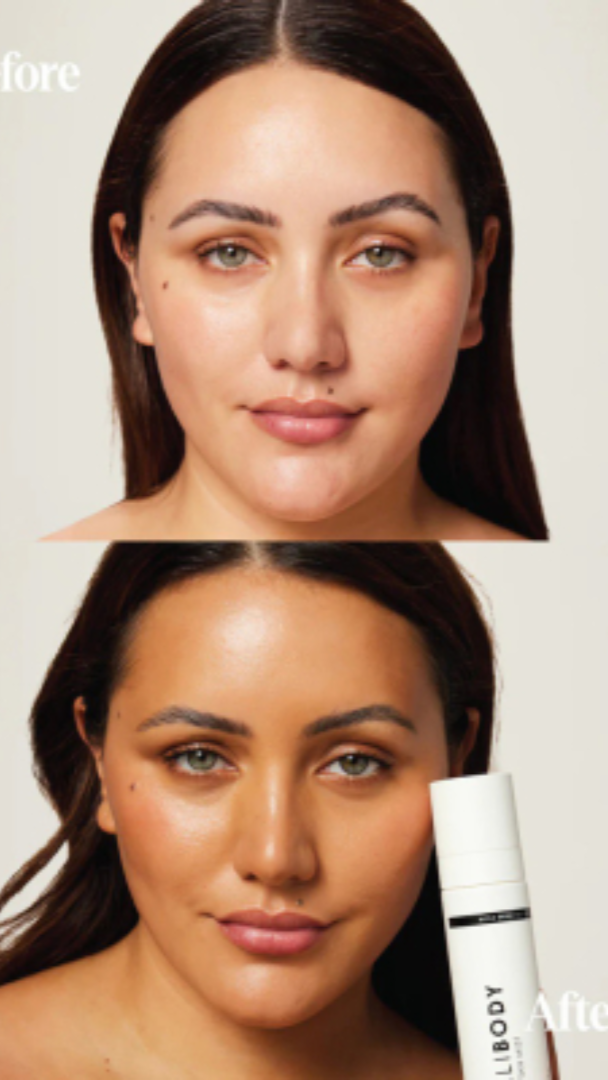 Before and after comparison of a woman's face with a skincare product shown.